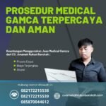 Prosedur medical gamca terpercaya dan aman